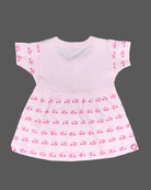 casual short frock
